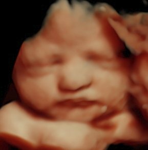 4d view ultrasound file